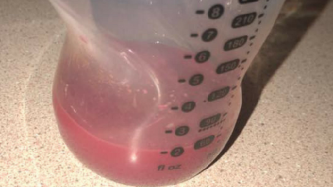 Pink breast milk