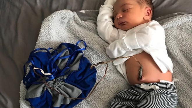 Lotus birth