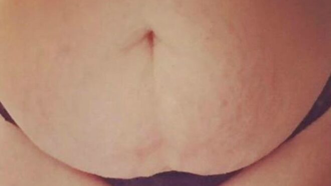 Postpartum body