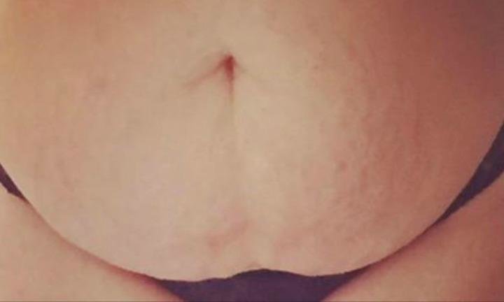 This Mom of 4 Is Crowdfunding a Tummy Tuck   People Have Strong Feelings - 68