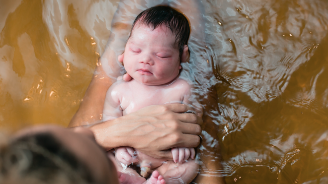 Down Syndrome water birth