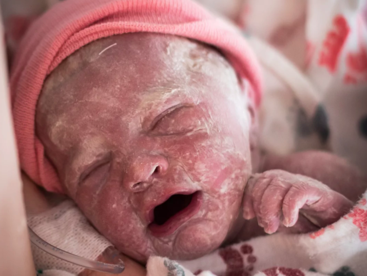 Newborn baby