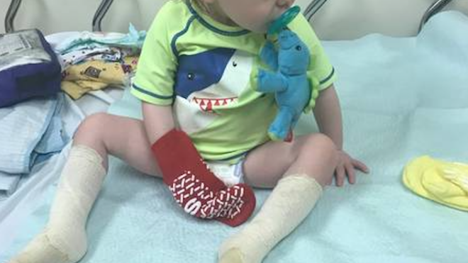 Jackson Sechrist's foot