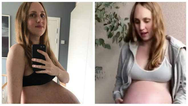 triplet baby bump photos