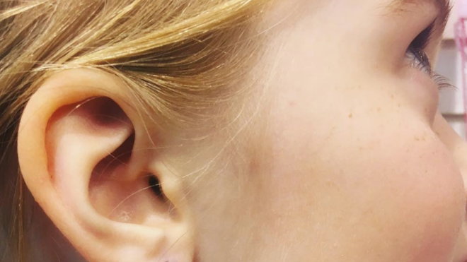 dad's ear piercing consent lesson