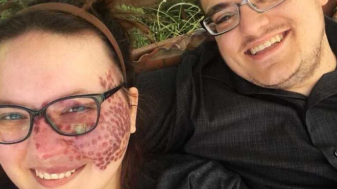 featured-img-of-post-216432