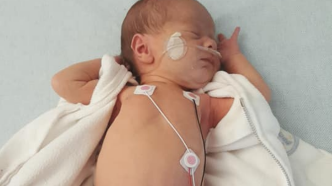 rsv in babies
