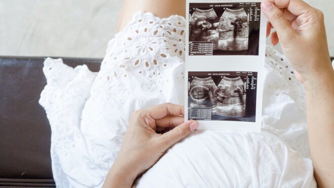 sonogram
