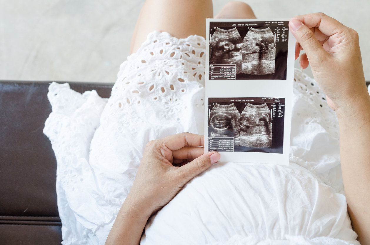 sonogram