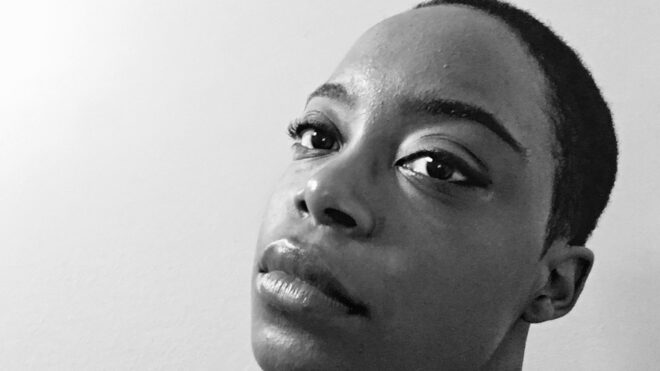 under-eye bags mary anderson