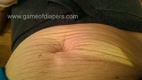 What a Non Celebrity s Postpartum Tummy Looks Like After Having Twins  PHOTOS  - 99