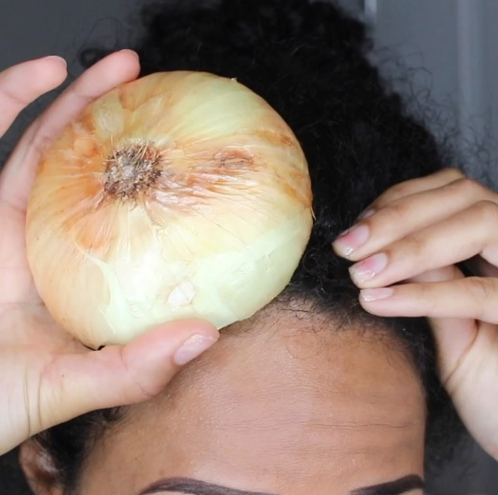 This Woman Put Onion Juice in Her Hair to Help It Grow - 73