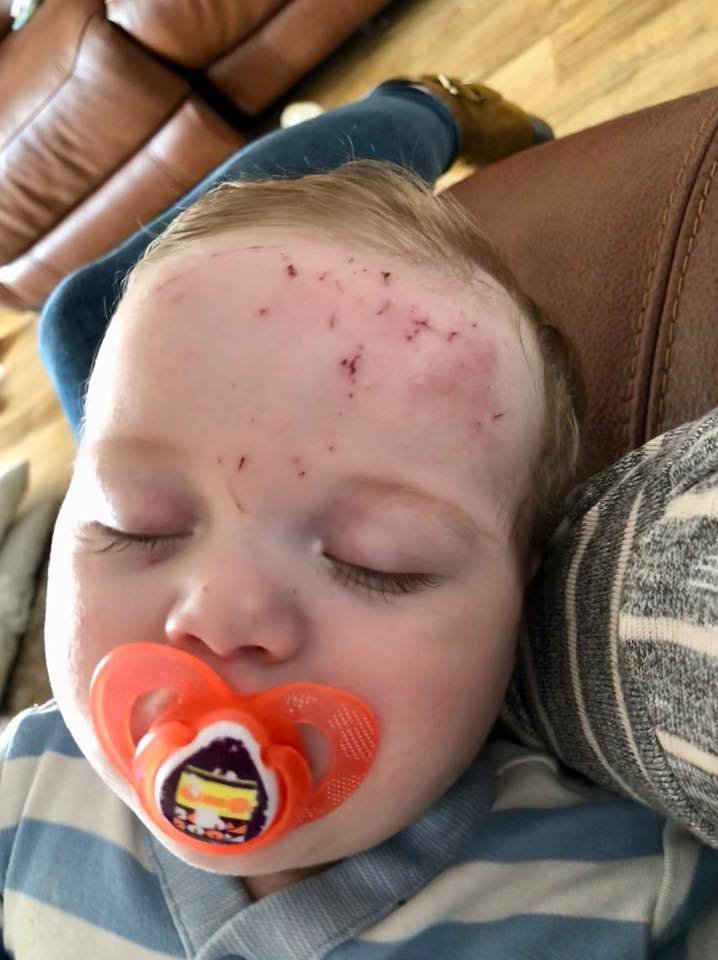 Mom Claims This  Dream Cream  Healed Her Baby s Eczema - 26