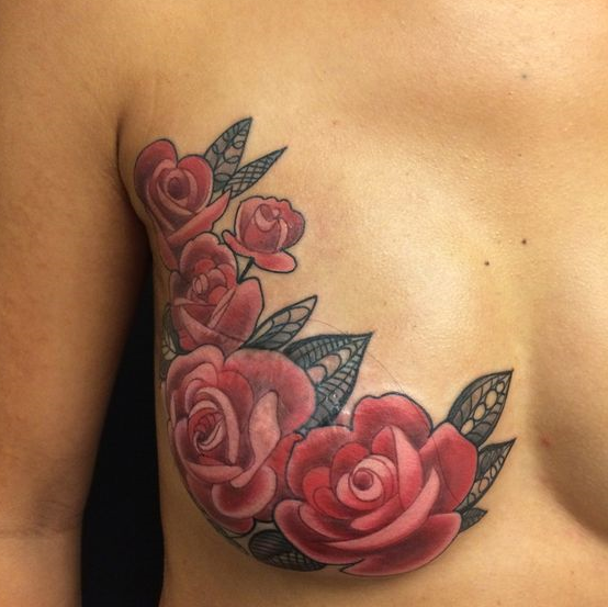 17 Tattoos That Prove Scars And Stretch Marks Are Works Of Art - 49