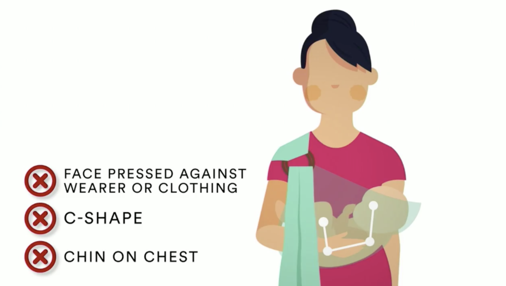doctors issue warning about baby carriers