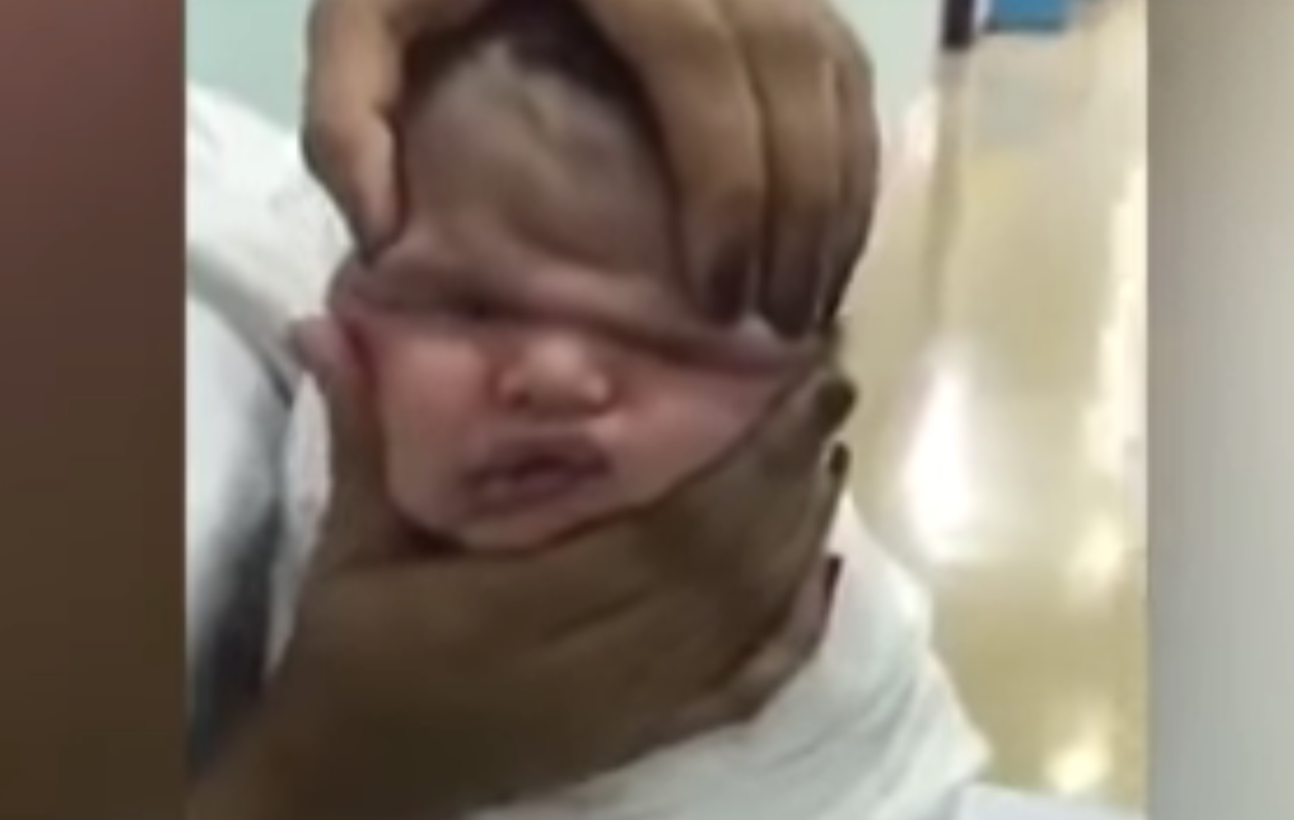 Nurses squishing baby's face