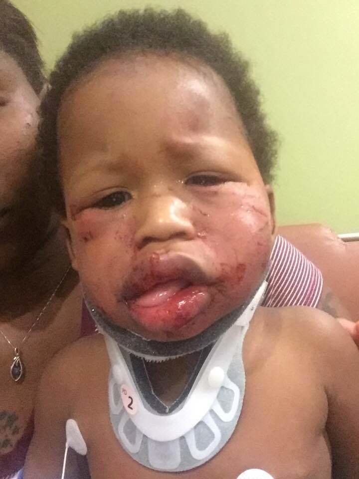 toddler beat up at daycare
