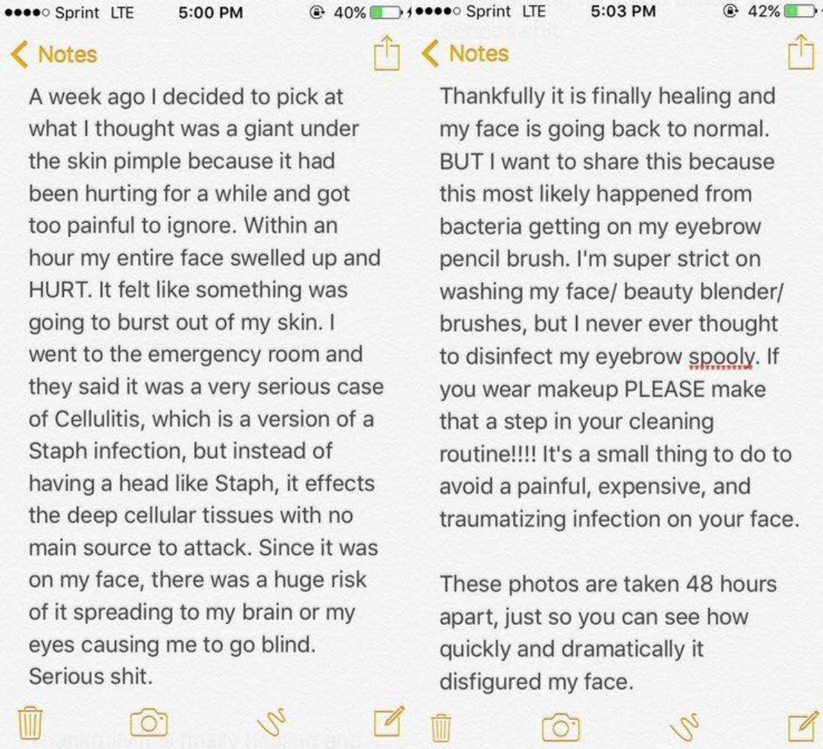 Katie Wright Staph Infection Makeup