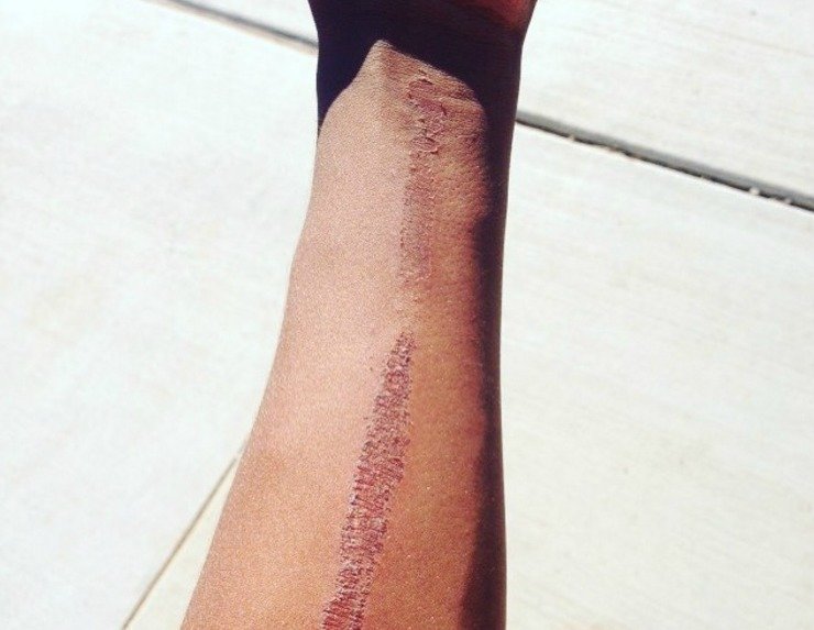 Effects of the eraser challenge
