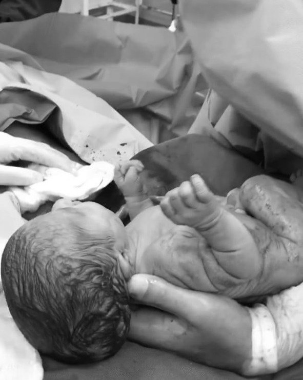Venezuelan OB/GYN Jham Frank Lugo shares incredible gentle C-section