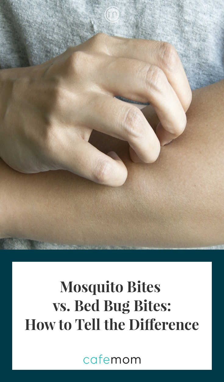 Mosquito Bites vs  Bed Bug Bites  How to Tell the Difference - 70