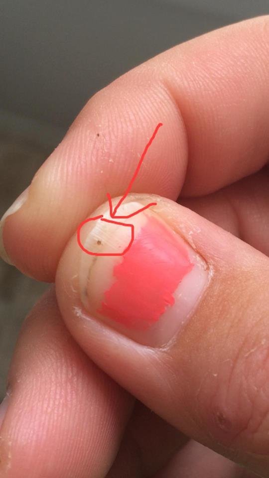 Seed tick
