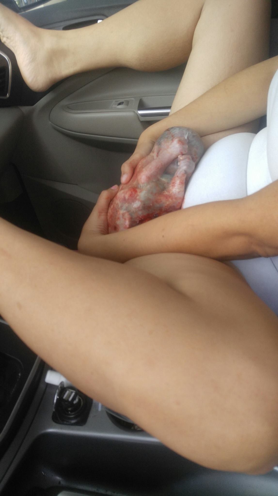 Baby born en caul 