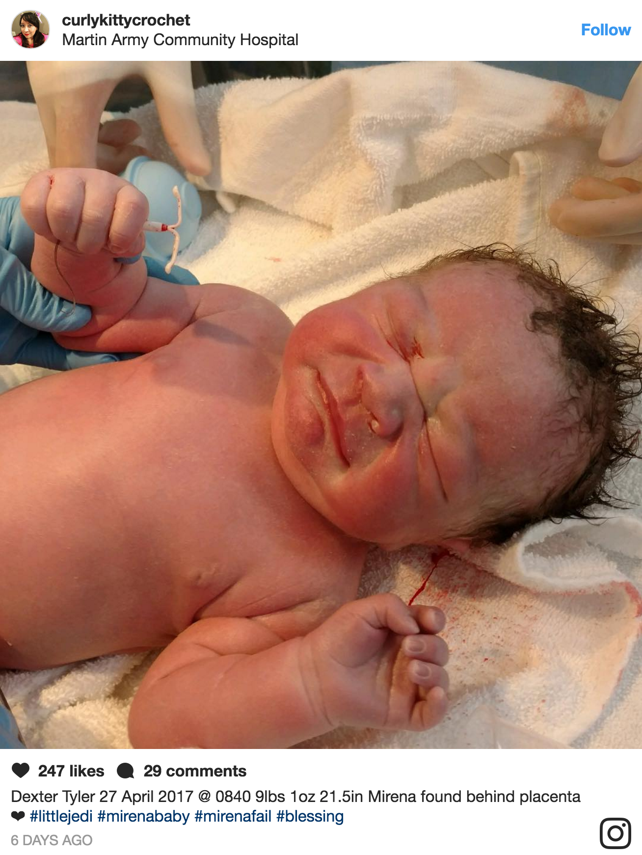 baby holding IUD