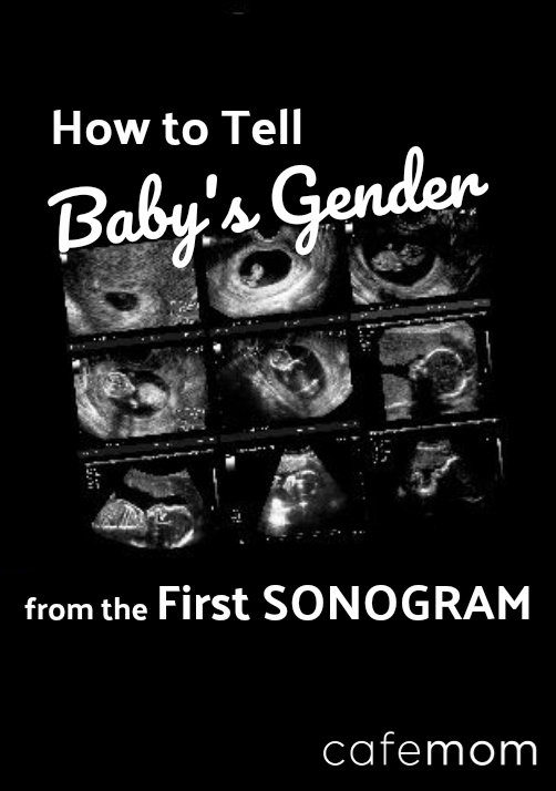 baby gender first sonogram