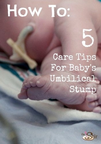umbilical cord care