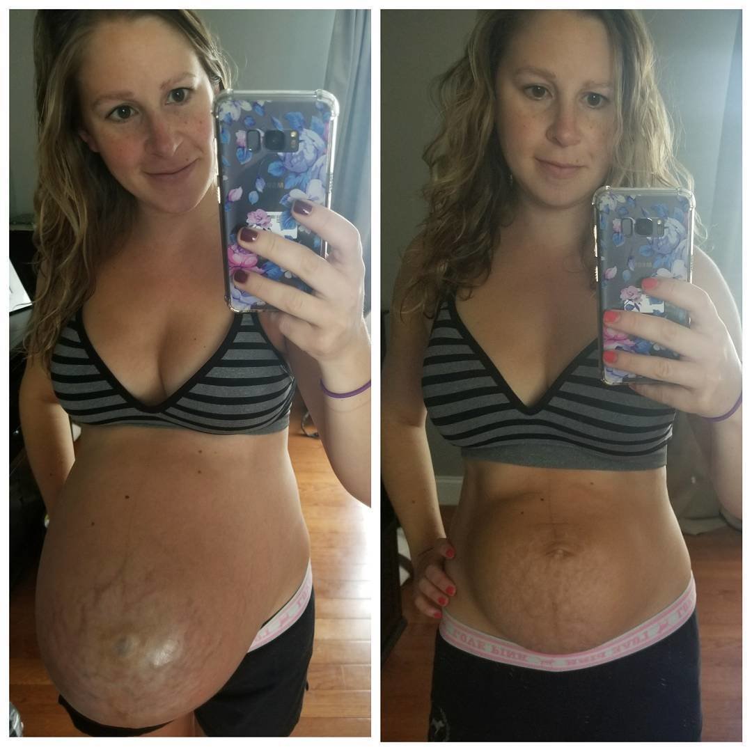 Baby bump before and after giving birth