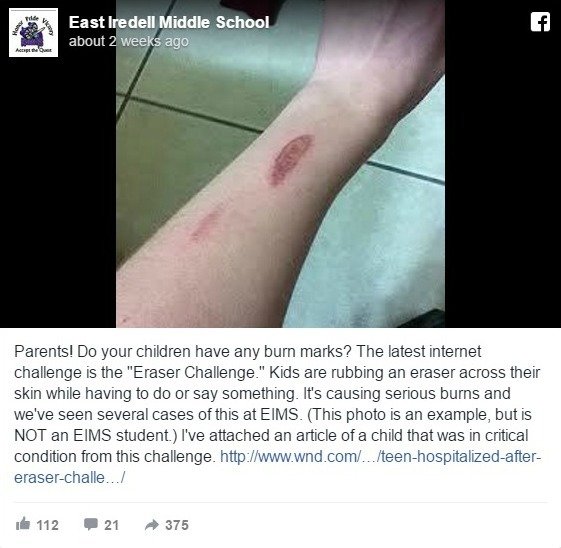 Effects of the eraser challenge