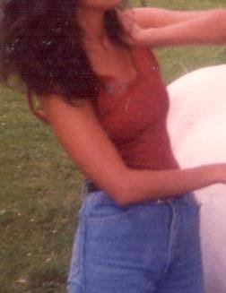 woman before implants