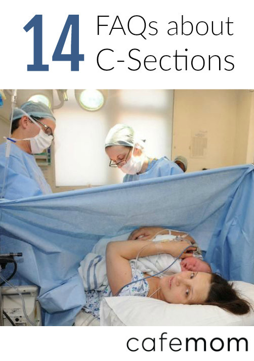 c section questions answers