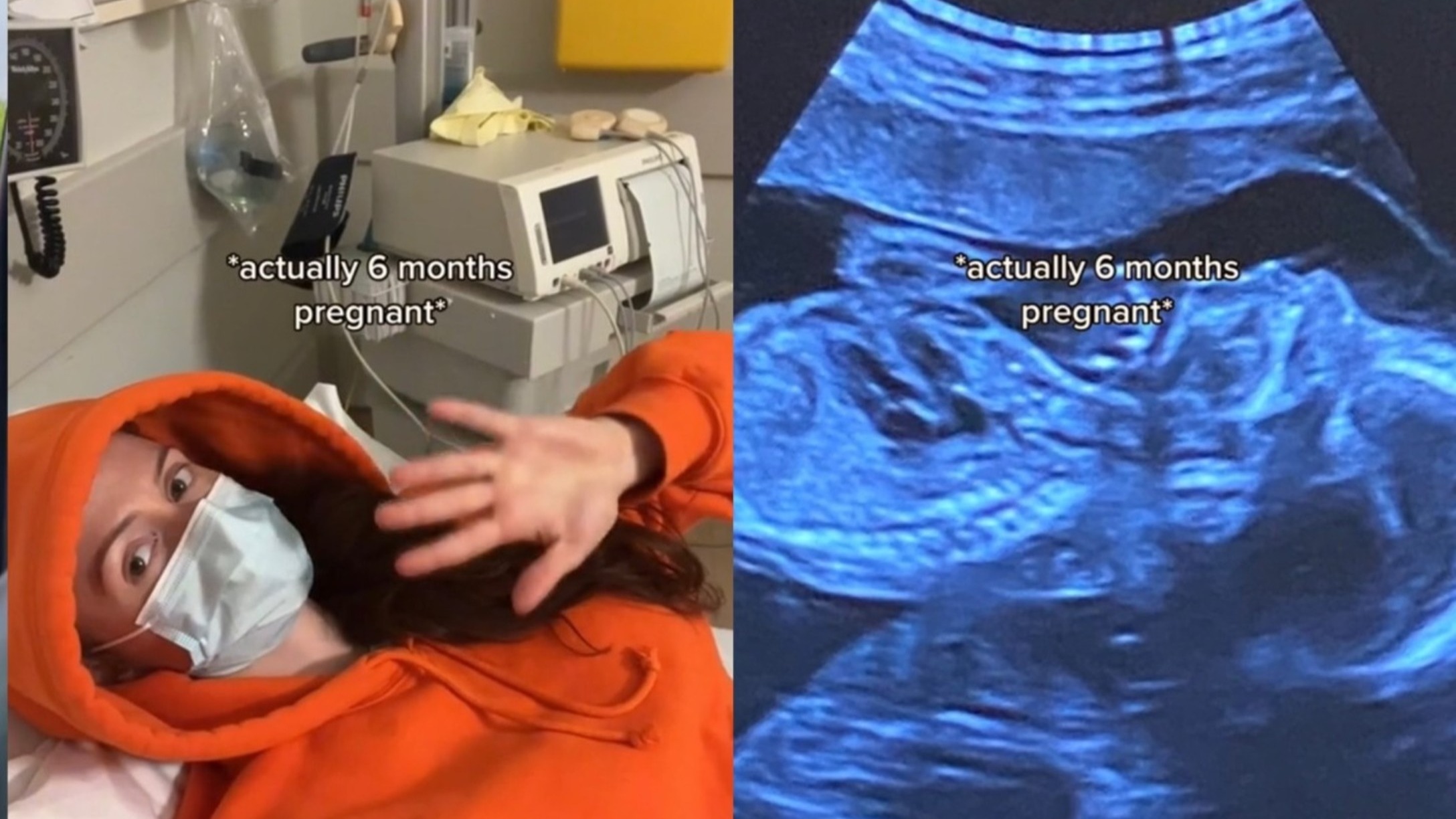 TikToker reveals she's 6 months pregnant after thinking she was just bloated.