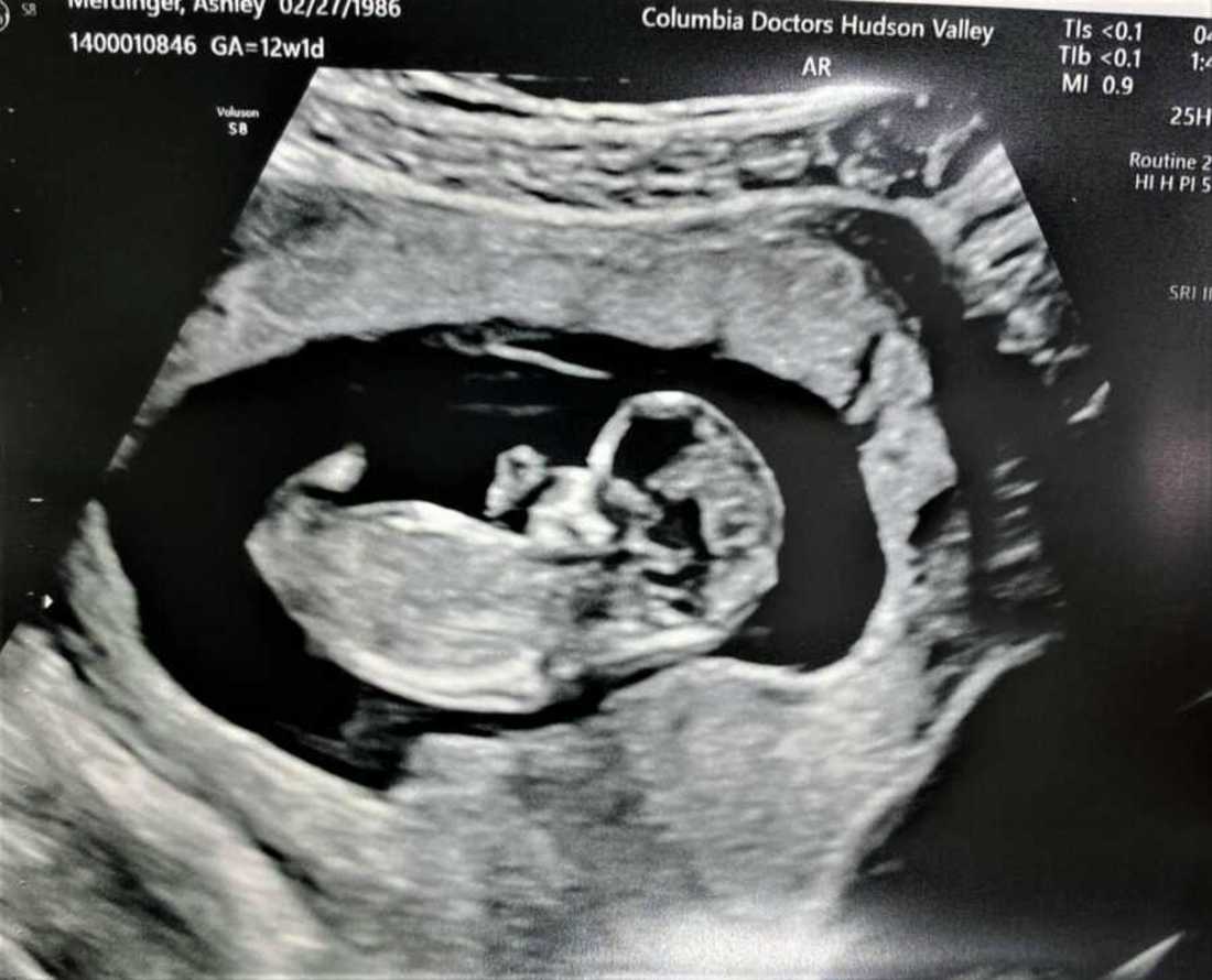 Ashley_Faith_abortion6-900x690-1.jpeg