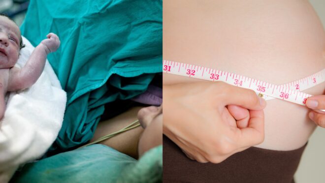 c-section