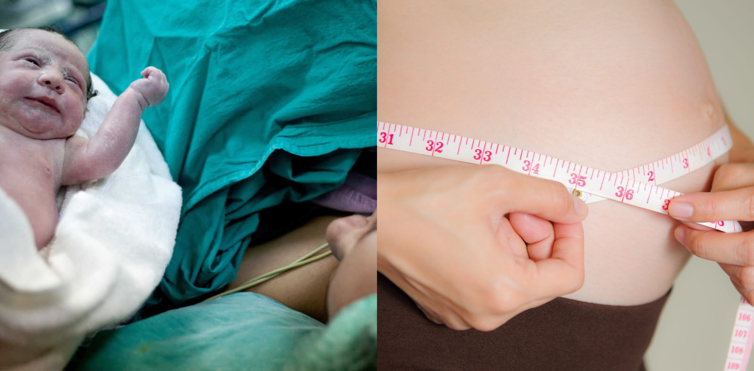 c-section