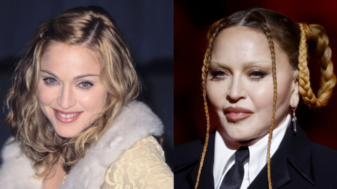 Madonna