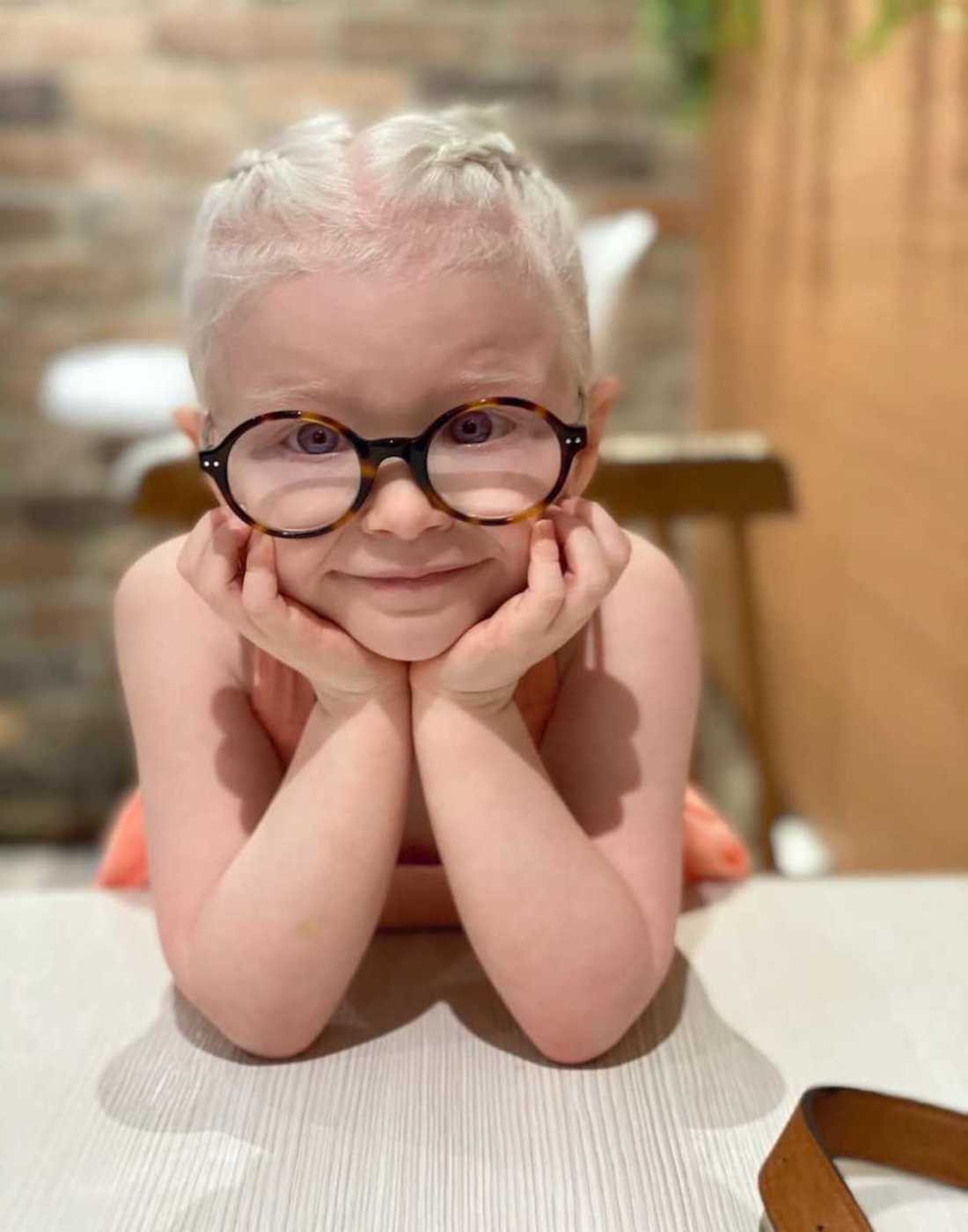 Hailey_Brown_albinism_specialneeds24-900x1200-1.jpeg