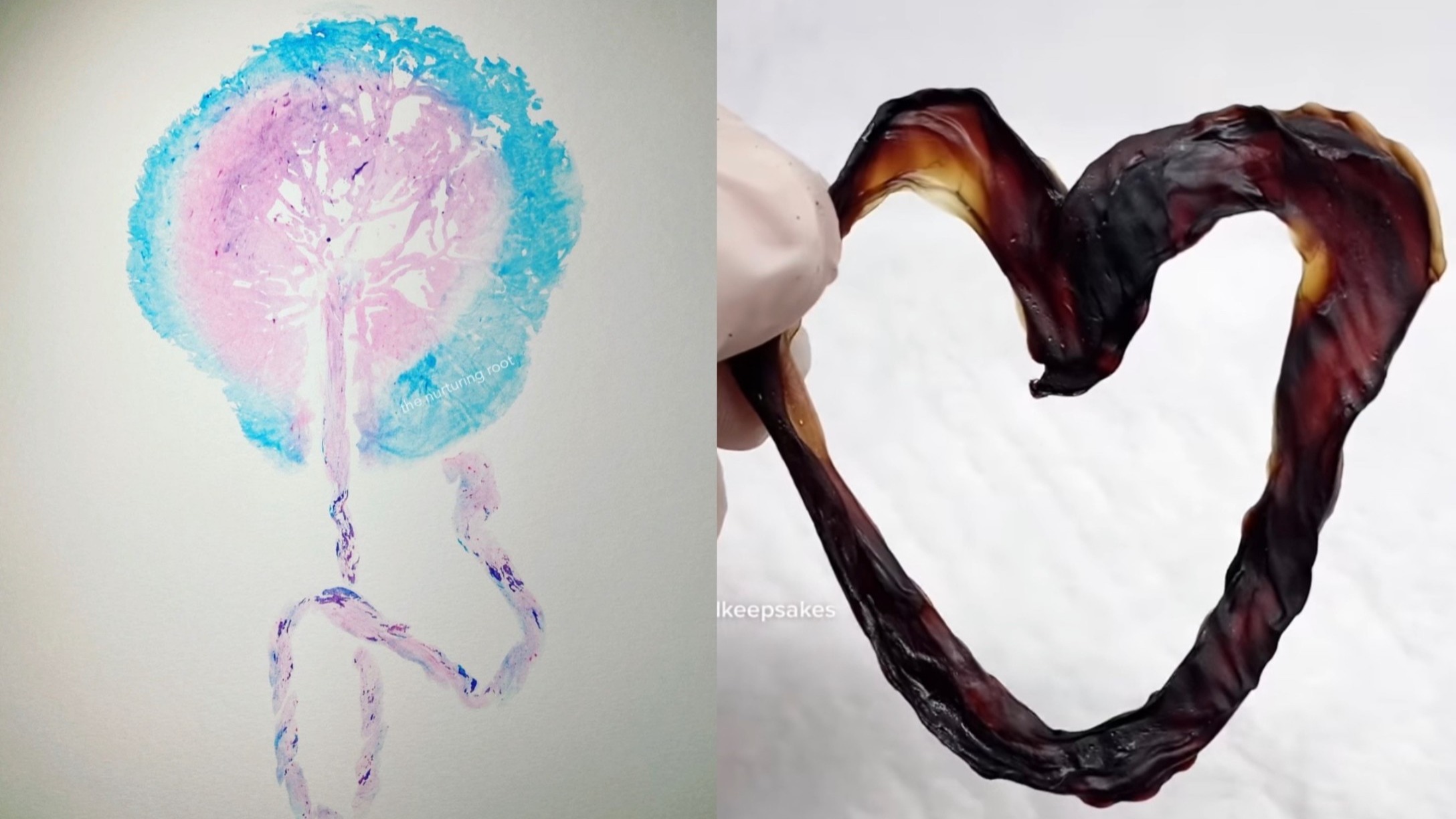 Umbilical Keepsakes