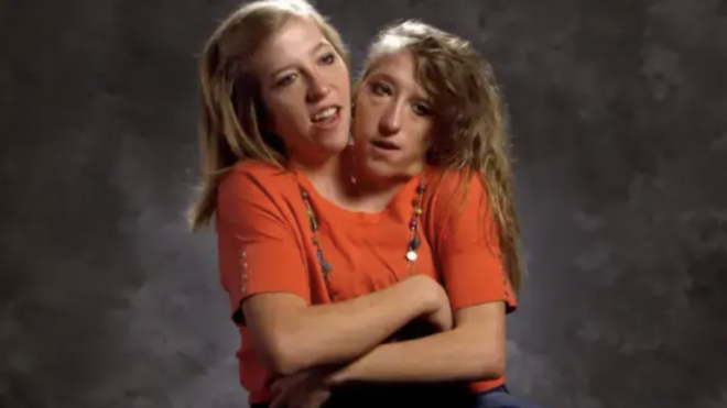 Abby & Brittany Hensel