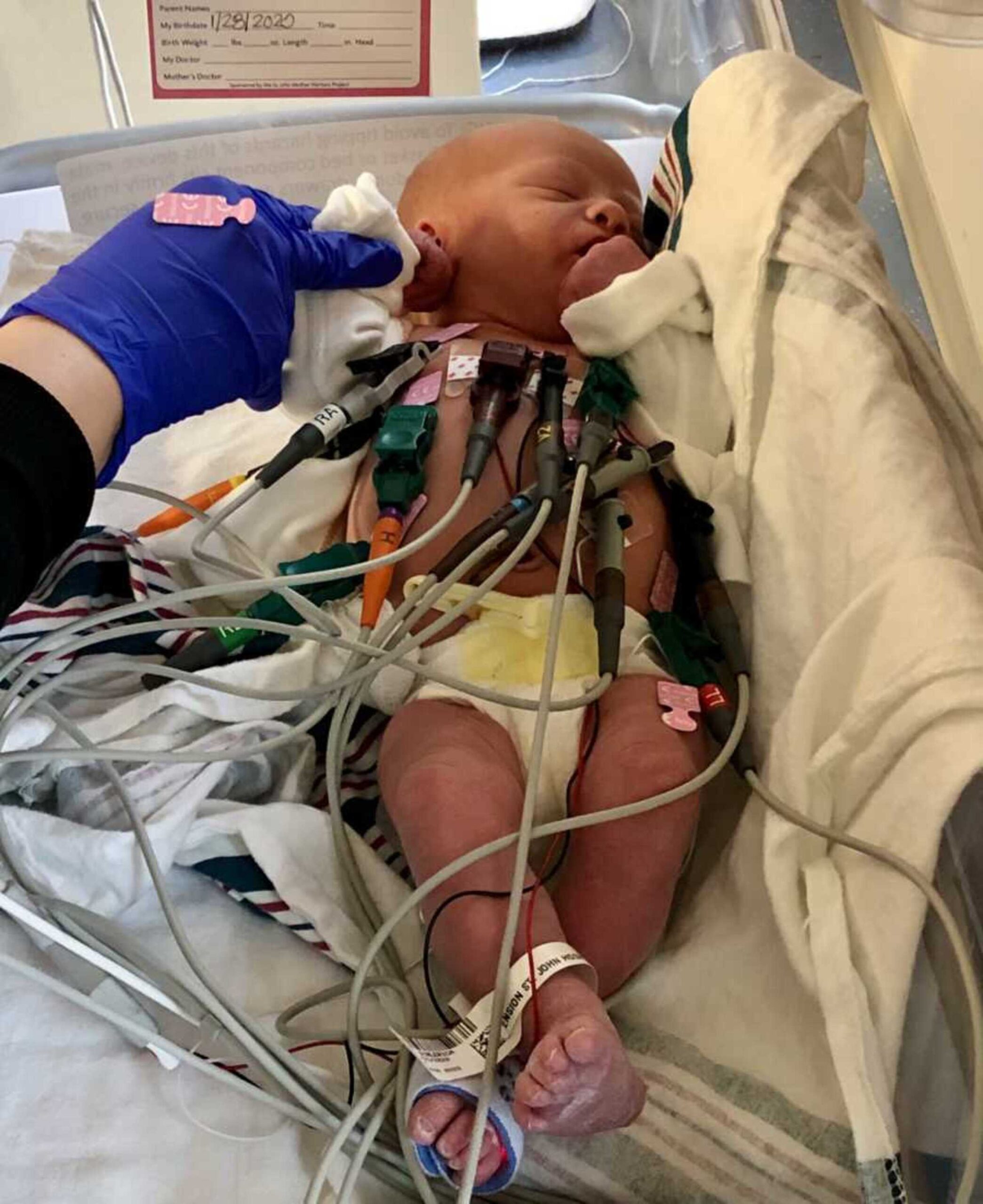 adoptive-baby-in-hospital-getting-treatment-900x1103-1.jpeg