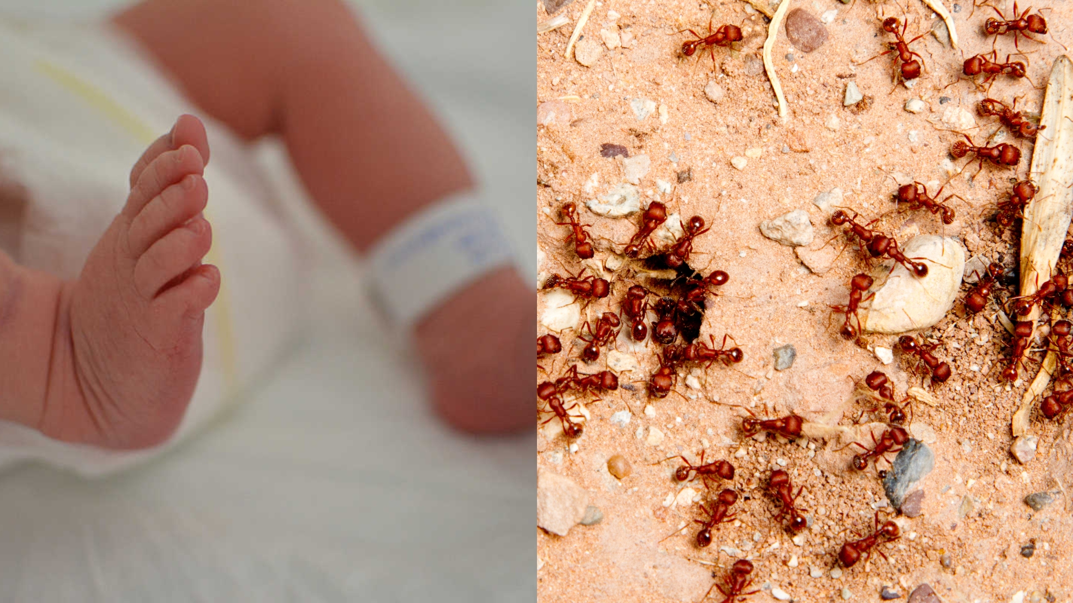 1-Day-Old Baby Girl Suffers Severe Sunburn & Bites After Being Left Alone on an Anthill