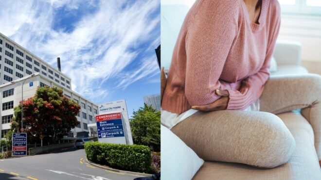 Auckland c-section