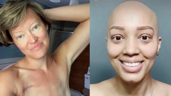 women with breast cancer