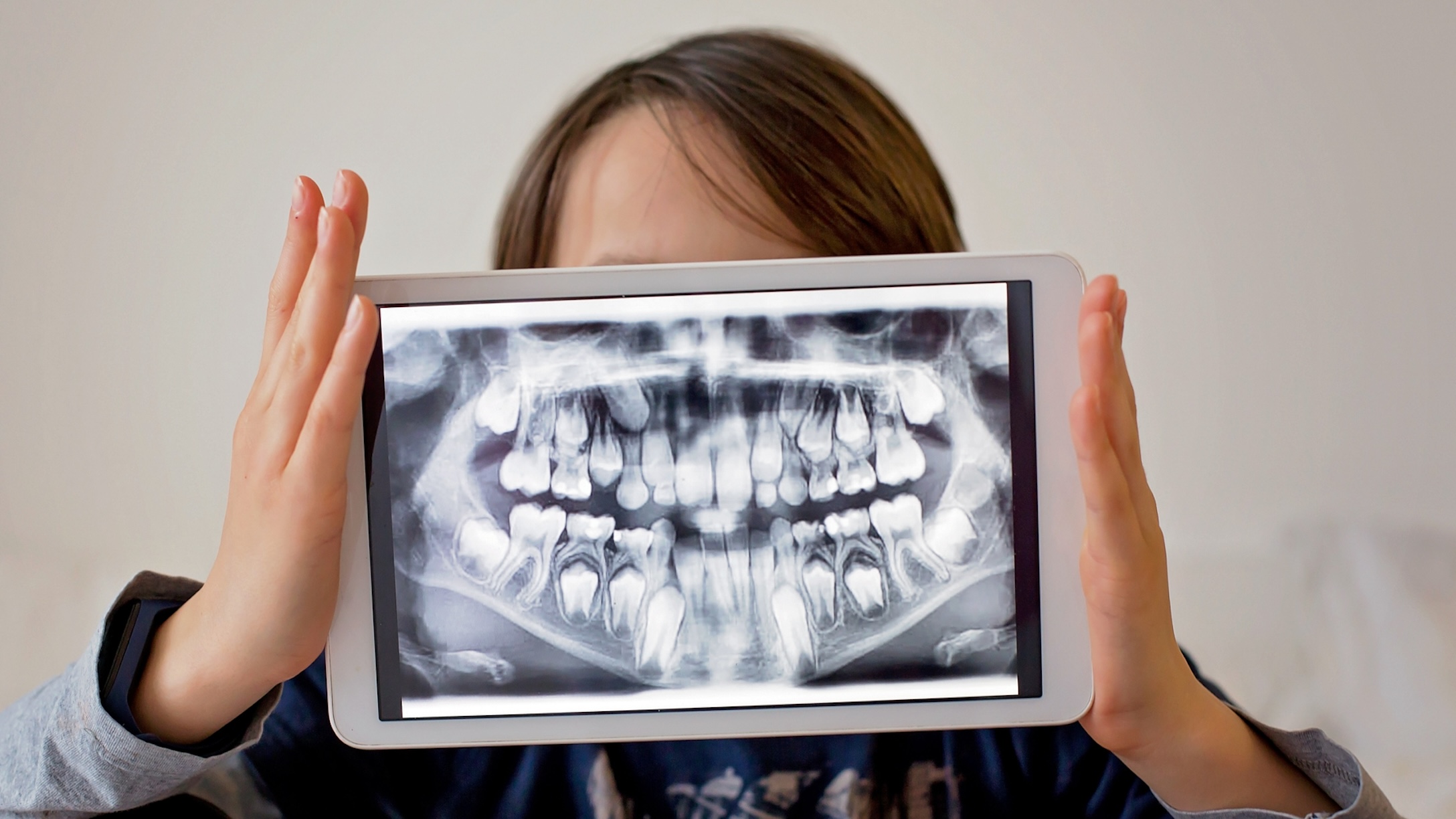 boy-india-teeth-removed