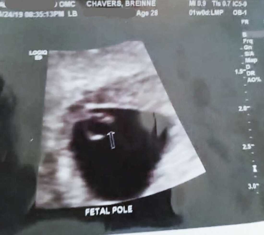 breinne_chavers_surprise_pregnancy_child_loss_lwm8-900x783-1.jpeg