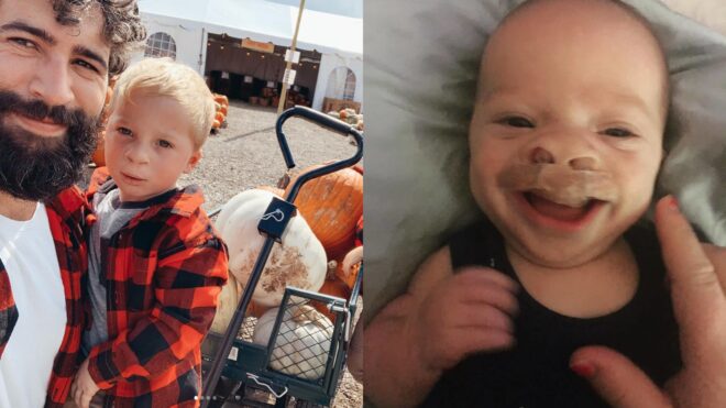cleft baby