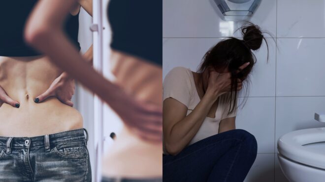 Eating disorders